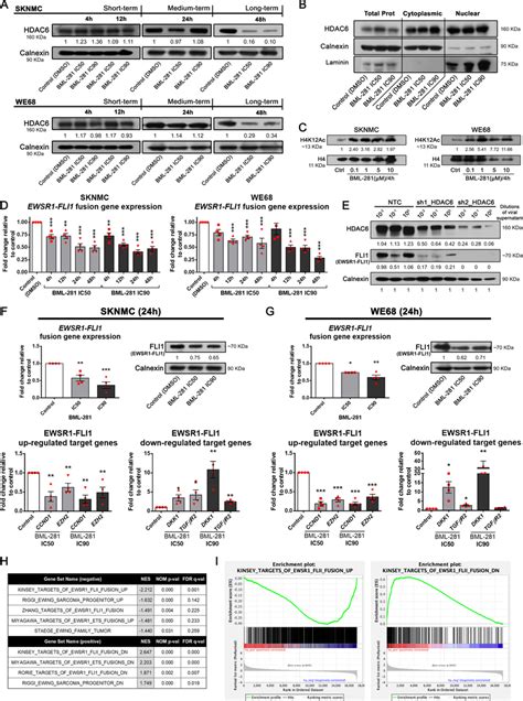 Inhibition Of Hdac6 Activity Induces Ewsr1 Fli1 Downexpression And