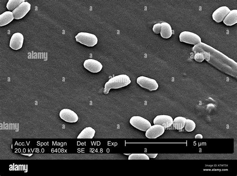 Bacillus Anthracis Micrograph Im Genes De Stock En Blanco Y Negro Alamy