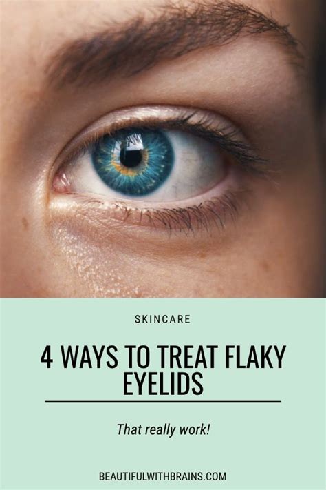 4 Ways To Treat Flaky Eyelids Dry Flaky Eyelids Dry Eyelids Dry Skin Care Routine