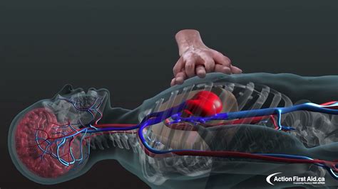 La RCP Réanimation Cardio Pulmonaire animation 3D YouTube