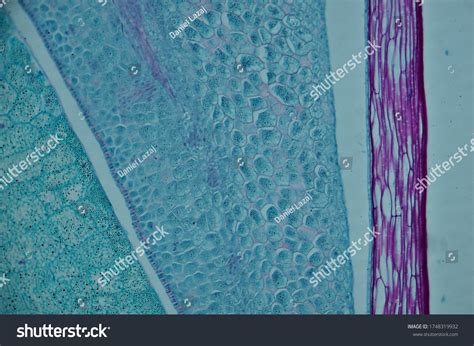 Corn Seed Endosperm Ls Under Microscope Stock Photo 1748319932