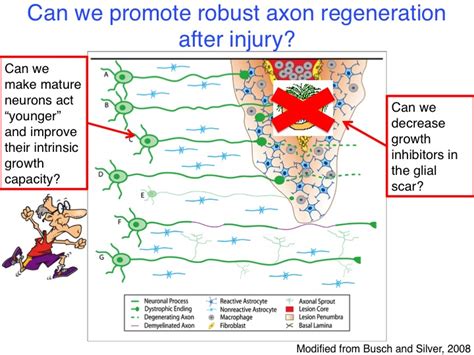 Axon Regeneration Tom Lab