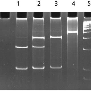 Agarose Gel Electrophoresis Pattern Of Gstm And Gstt Multiplex