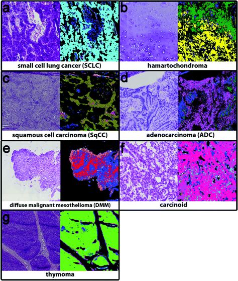 Marker Free Automated Histopathological Annotation Of Lung Tumour