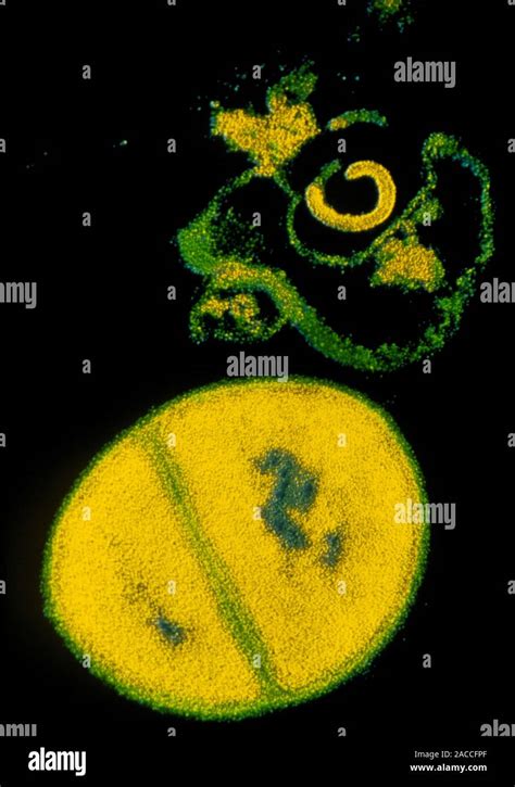 False Colour Transmission Electron Micrograph Tem Of Bacteria