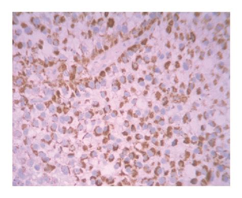 Histopathological Staining Findings A Hande Staining Showing High Download Scientific Diagram