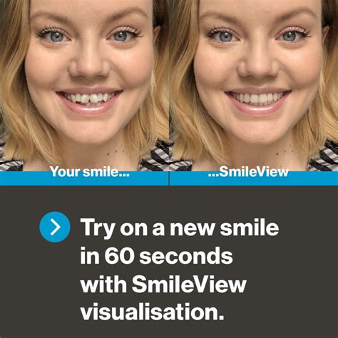 Teeth Straightening With Invisalign London Orthodontist