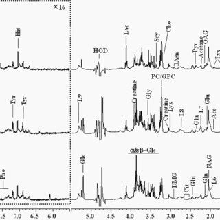 Opls Da Score Plots Left Panel Derived From H Nmr Spectra Of Serum