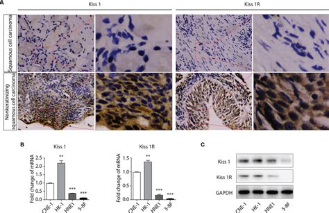 Expression Of Kiss1 And Kiss1r Gene Positively With Differentiation