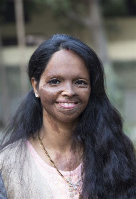 Inspiring Story Of Laxmi Agarwal, The Acid Attack Survivor Deepika ...