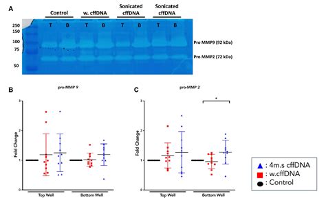 Fetal Dna Causes Sex Specific Inflammation From Human Fetal Membranes