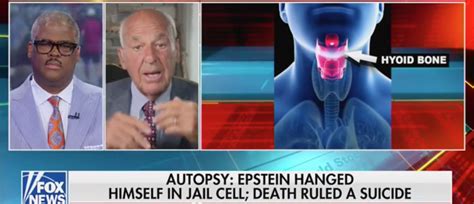 Forensic Pathologist Says Epstein Fractures Would Only Happen ‘if He