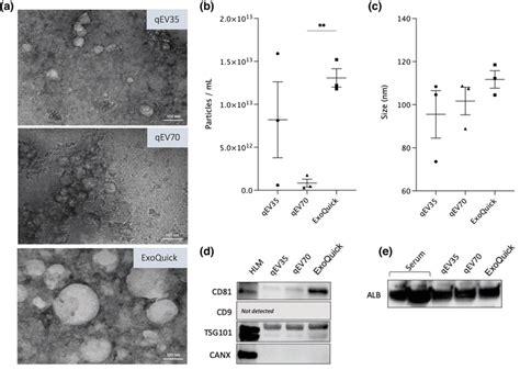 Characterisation Of Extracellular Vesicles Isolated By Sec And