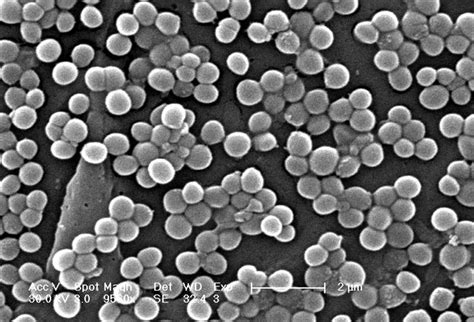 Free Picture Methicillin Resistant Staphylococcus Aureus Bacteria