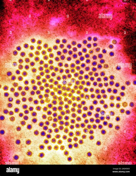 Astrovirus particles. Coloured transmission electron micrograph (TEM) of a cluster of astrovirus ...