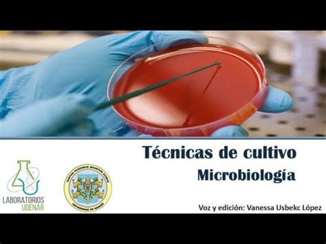 Técnicas de siembra Microbiología YouTube