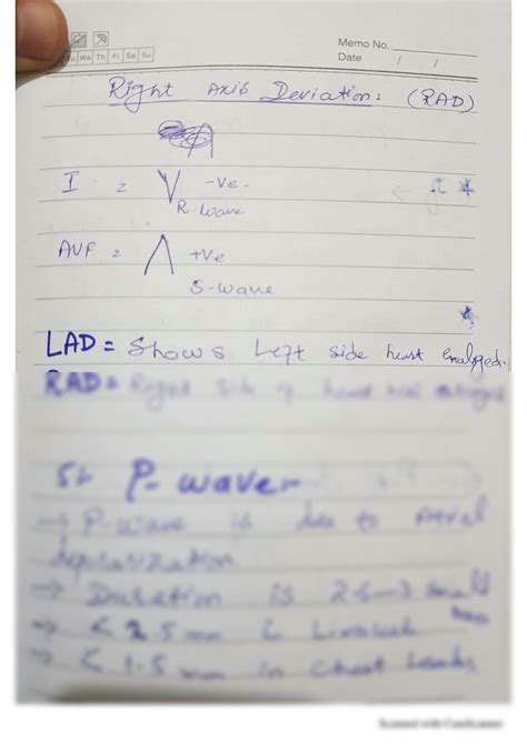 Solution Ecg Ekg Interpretation Made Easy Studypool