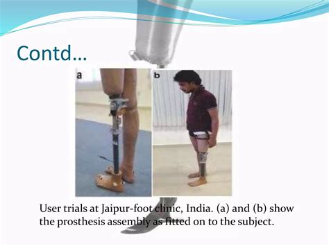 Designof A Fully Passive Prosthetic Knee Ppt Free Download