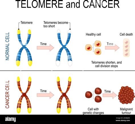 Chromosome and telomere for healthy and cancerous cells. In a normal ...