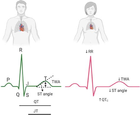 Sex Differences In Electrocardiogram Ecg Interval Between Two