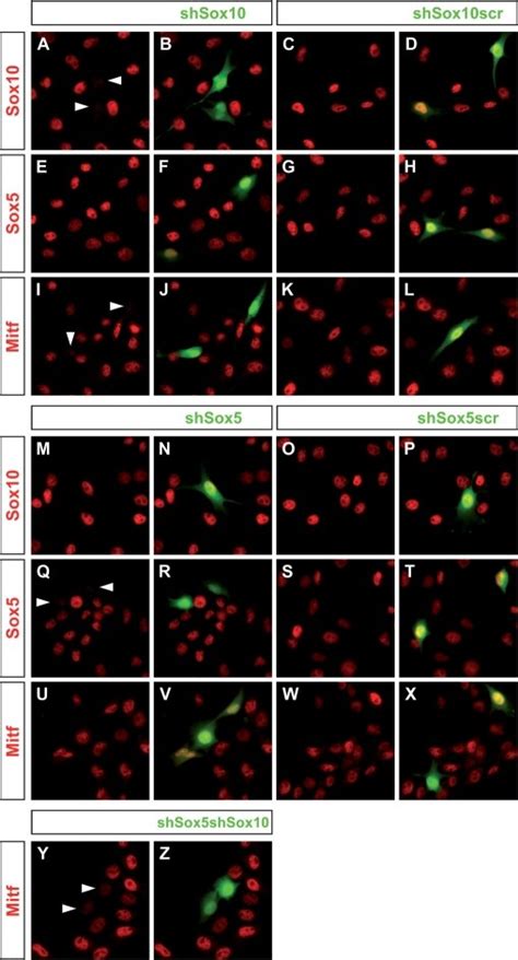 Sox And Sox Influence Melanocyte Specific Gene Expression In B