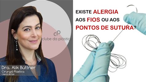 Clube Da Pl Stica Existe Alergia Aos Fios Ou Aos Pontos De Sutura