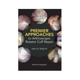 Premier Approaches To Arthroscopic Rotator Cuff Repair Kelly Eurospan