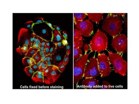 Immunofluorescence Tips For Immunostaining Cultured Cells