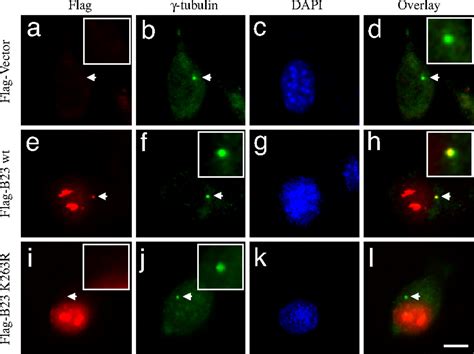 Sumoylation Of Nucleophosmin B Regulates Its Subcellular Localization