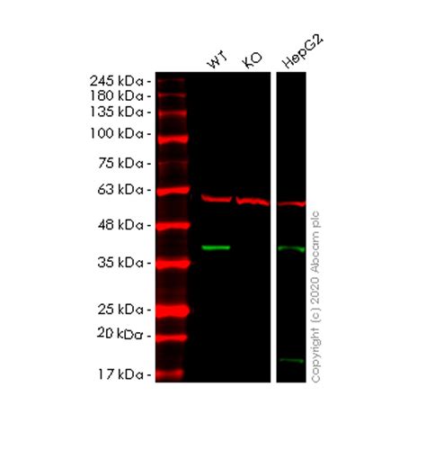 Recombinant Anti AIP Antibody EPR13585 KO Tested Ab192024 Abcam