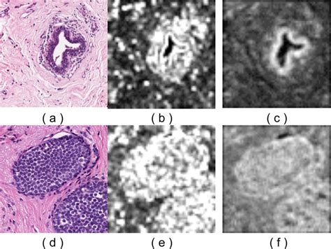 Supervised Extraction Of Histological Features To Describe Tissue