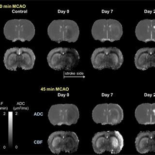 Group Averaged Cerebral Blood Flow CBF And Apparent Diffusion