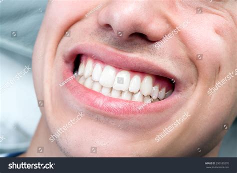 Macro Close Human Male Mouth Showing Stock Photo Shutterstock