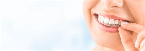 Beneficios De La Ortodoncia Invisible Cl Nica Dental Mayo