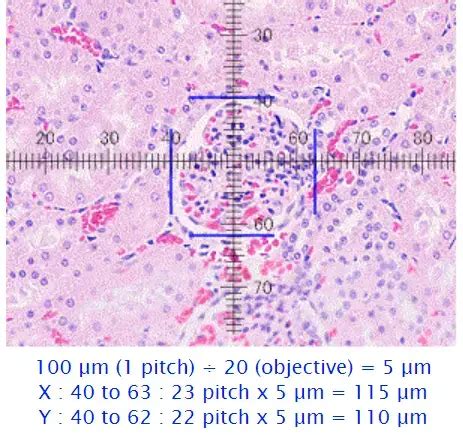 Ocular Micrometer - Definition, Principle, Parts, Applications ...