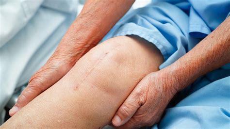 Alternative To Knee Revision Surgery Arthritis Knee Pain Centers