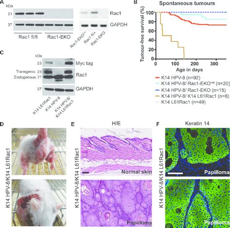 Epidermis Specific Deletion Or Activation Of Rac Determines Hpv