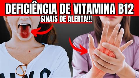 Os 10 Principais Sintomas De Deficiência De Vitamina B12 Que Você Deve Conhecer Sinais De