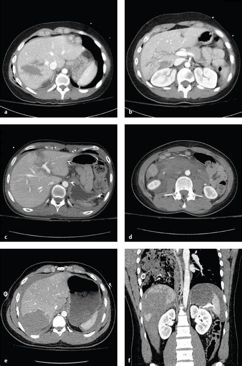 Abdomen And Pelvis Radiology Key