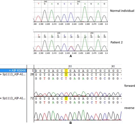 A Patient 2 Germline Dna Showing A Heterozygous Mutation At Locus 910