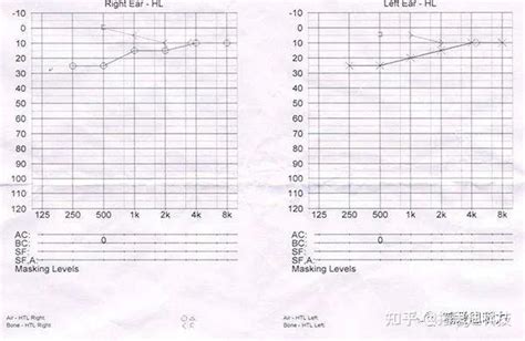 5分钟教你看懂听力图 知乎