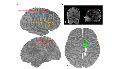 primary motor cortex   brain  schematic  zones