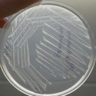 Bacterial Colonies Streptococcus Agalactiae On Muller Hinton Agar