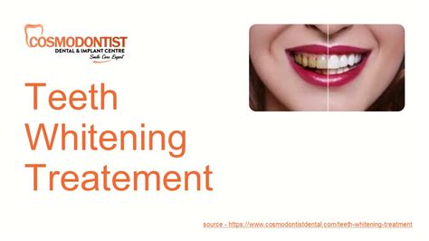 Ppt Teeth Whitening Treatment Powerpoint Presentation Free To