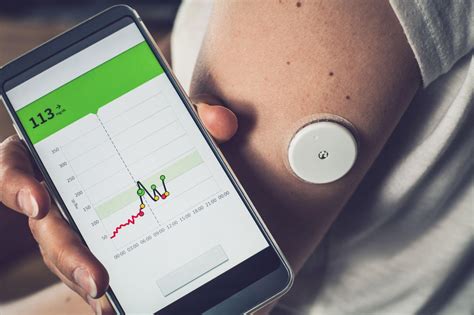 Benefits of Using a Continuous Glucose Monitor | Aptiva Medical
