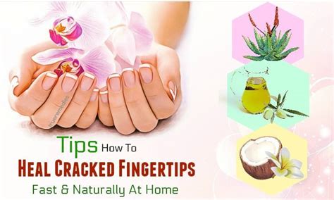 19 Tips How To Heal Cracked Fingertips Fast At Home