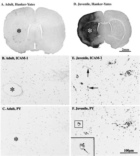 Loss Of The Tight Junction Proteins Occludin And Zonula Occludens