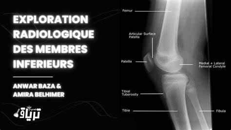 Radiologie Exploration Radiologique Des Membres Inferieurs Par Anwar