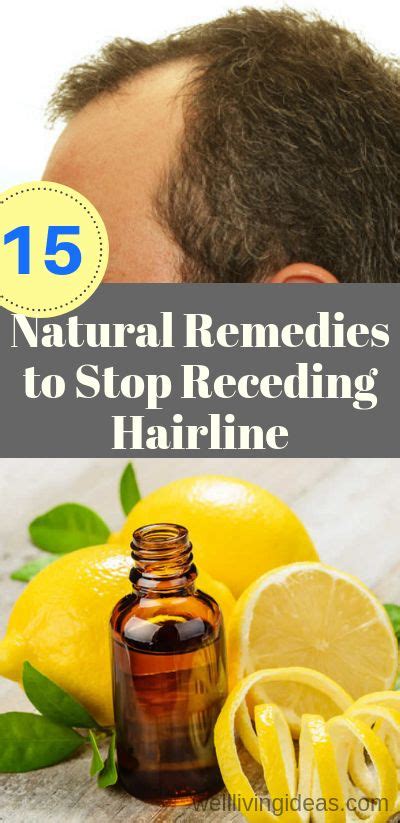 15 Natural Remedies To Stop Receding Hairline And Regrow Hair That