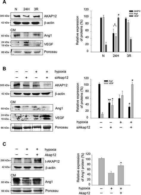 Akap12 Differentially Regulates The Expression Of Ang1 And Vegf A